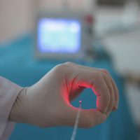 Endovasal Lazer, Эндовазальная Лазерная Абляция